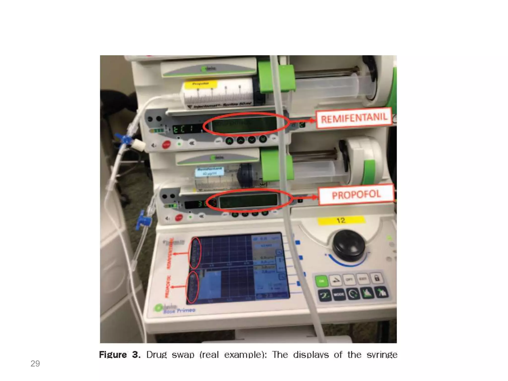 Total intravenous anesthesia (TIVA) PPT