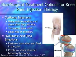 Non-Surgical Treatment Options for Knee Pain: Injection Therapy  Cortisone Injections Helps reduce swelling and discomfort from arthritis. Temporary pain relief. Small risk of infection. Hyaluronic Acid (HA) Injections Restores lubrication and fluid in the joint. Creates a shock absorber between the bones. Source:  www.AllAboutArthritis.com  , 2003 
