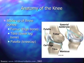 Made up of three bones:  Femur (thigh bone) Tibia (lower leg bone)  Patella (kneecap) Anatomy of the Knee Source:  www.AllAboutArthritis.com  , 2003 
