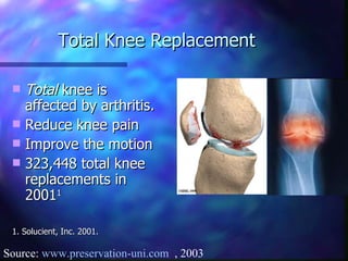 Total Knee Replacement Total  knee is affected by arthritis. Reduce knee pain Improve the motion 323,448 total knee replacements in 2001 1 1. Solucient, Inc. 2001. Source:  www.preservation-uni.com   , 2003 