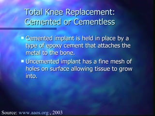 Total Knee Replacement: Cemented or Cementless Cemented implant is held in place by a type of epoxy cement that attaches the metal to the bone. Uncemented implant has a fine mesh of holes on surface allowing tissue to grow into. Source:  www.aaos.org  , 2003 