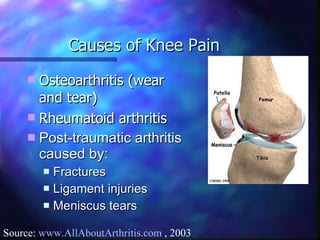 Causes of Knee Pain Osteoarthritis (wear and tear) Rheumatoid arthritis Post-traumatic arthritis caused by:  Fractures Ligament injuries Meniscus tears Source:  www.AllAboutArthritis.com  , 2003 