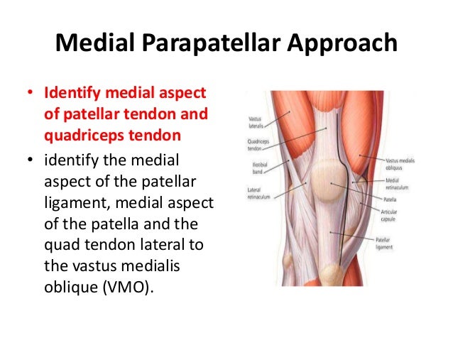 Arthrotomy Of Knee