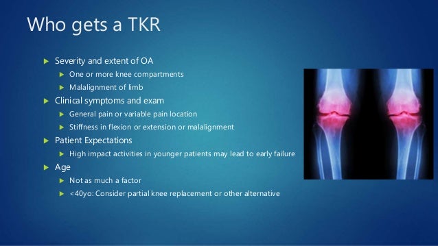 Total Knee Arthroplasty Knee Replacement South Windsor Rocky Hil