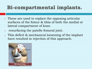 Bi-compartmental implants.
 These are used to replace the opposing articular
surfaces of the femur & tibia of both the medial or
lateral compartment of knee.
 resurfacing the patello femoral joint.
 This deficit & mechanical loosening of the implant
have resulted in rejection of this approach.
 