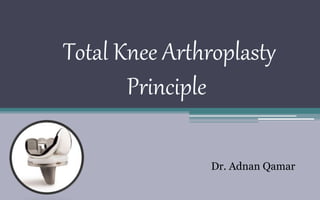 Total Knee Arthroplasty
Principle
Dr. Adnan Qamar
 
