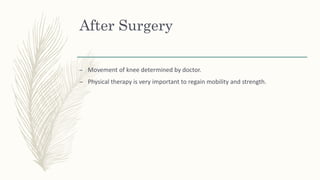 After Surgery
– Movement of knee determined by doctor.
– Physical therapy is very important to regain mobility and strength.
 