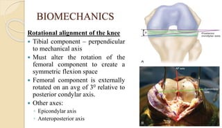 BIOMECHANICS
Rotational alignment of the knee
 Tibial component – perpendicular
to mechanical axis
 Must alter the rotation of the
femoral component to create a
symmetric flexion space
 Femoral component is externally
rotated on an avg of 30 relative to
posterior condylar axis.
 Other axes:
◦ Epicondylar axis
◦ Anteroposterior axis
 