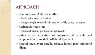 APPROACH
 Skin incision: Anterior midline
◦ Made with knee in flexion
◦ Long enough to avoid skin tension while using retractors
 Retinacular incision
◦ Standard medial parapatellar approach
 Subperiosteal elevation of anteromedial capsule and
deep portion of medial collateral ligament
 Extend knee, evert patella, release lateral patellofemoral
plicae
 