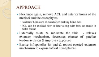 APPROACH
 Flex knee again, remove ACL and anterior horns of the
menisci and the osteophytes.
◦ Posterior horns are excised after making bone cuts
◦ PCL can be excised now or later along with box cut made in
distal femur
 Externally rotate & subluxate the tibia - relaxes
extensor mechanism, decreases chance of patellar
tendon avulsion & improves exposure
 Excise infrapatellar fat pad & retract everted extensor
mechanism to expose lateral tibial plateau
 