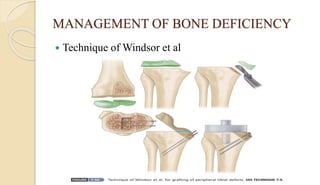 MANAGEMENT OF BONE DEFICIENCY
 Technique of Windsor et al
 