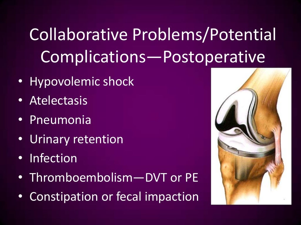Total knee replacement nursing management