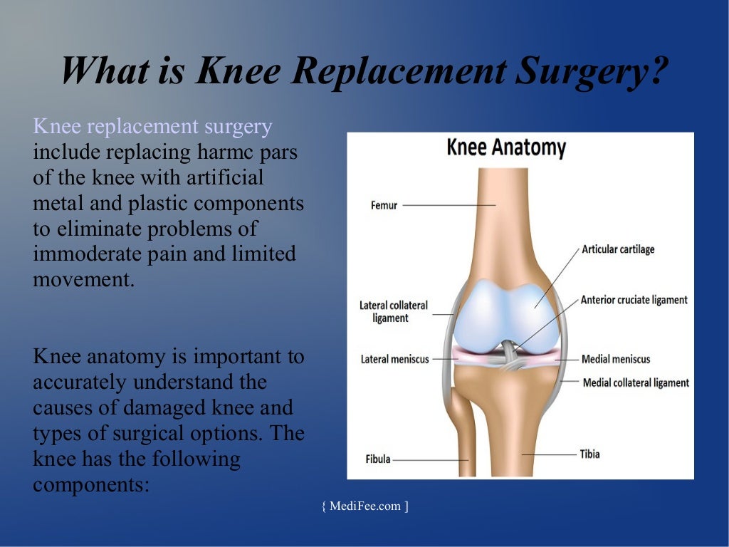 Total knee replacement surgery
