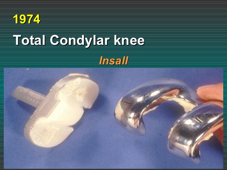 Total Knee Replacement