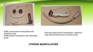 TOTAL LAPROSCOPIC HYSTERECTOMY PROCEDURE | PPTX