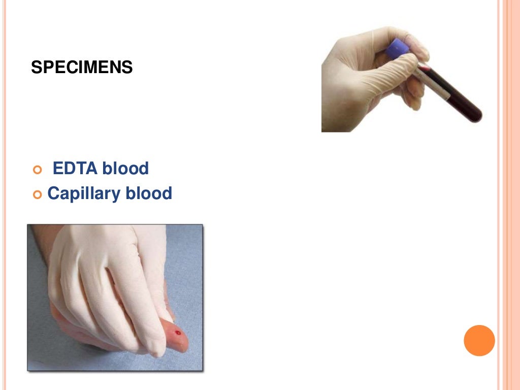Total leukocyte count TLC
