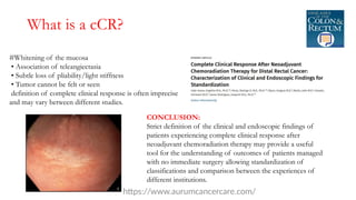Total Neoadjuvant Therapy for Rectal Cancer –Surgeon’s Perceptive.pptx