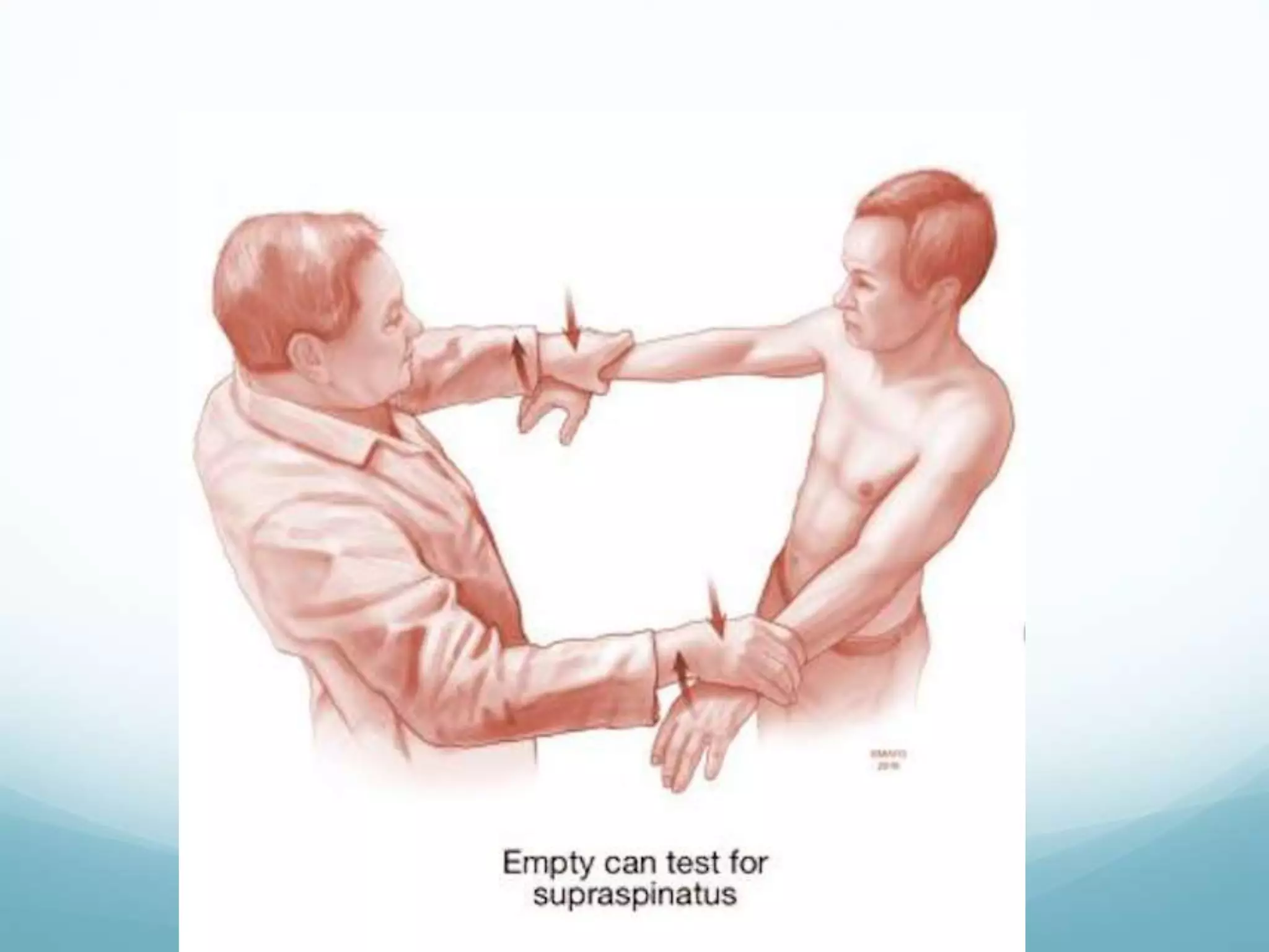 Tsa Rts A Total shoulder arthroplasty and reverse TSA - Hussain Algawahmed | PPTX