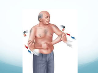 Tsa Rts A Total shoulder arthroplasty and reverse TSA - Hussain Algawahmed | PPTX