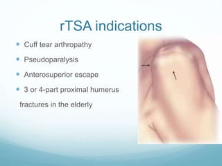 Tsa Rts A Total shoulder arthroplasty and reverse TSA - Hussain Algawahmed | PPTX