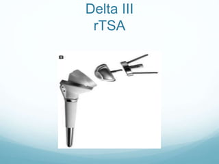 Tsa Rts A Total shoulder arthroplasty and reverse TSA - Hussain Algawahmed | PPTX