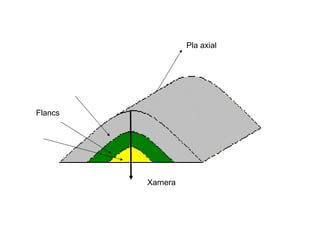Pla axial  Xarnera Flancs 