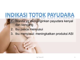 1. Wanita yg menginginkan payudara kenyal
dan kencang
2. Ibu pasca menyusui
3. Ibu menyusui: meningkatkan produksi ASI
By. Triana SP 6
 