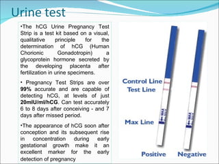 •The hCG Urine Pregnancy Test
Strip is a test kit based on a visual,
qualitative      principle   for  the
determination of hCG (Human
Chorionic         Gonadotropin)     a
glycoprotein hormone secreted by
the developing placenta after
fertilization in urine specimens.
• Pregnancy Test Strips are over
99% accurate and are capable of
detecting hCG, at levels of just
20mIU/ml/hCG. Can test accurately
6 to 8 days after conceiving - and 7
days after missed period.
•The appearance of hCG soon after
conception and its subsequent rise
in   concentration   during  early
gestational growth make it an
excellent marker for the early
detection of pregnancy
 