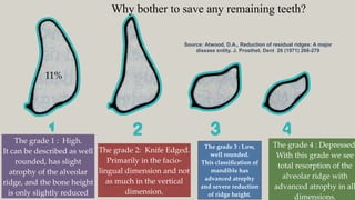 Totth supported overdenture (part 1) | PPTX