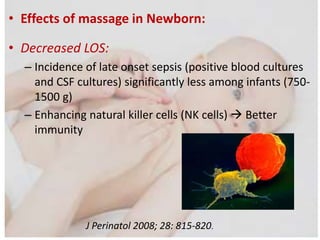 • Effects of massage in Newborn:
• Decreased LOS:
– Incidence of late onset sepsis (positive blood cultures
and CSF cultures) significantly less among infants (750-
1500 g)
– Enhancing natural killer cells (NK cells)  Better
immunity
J Perinatol 2008; 28: 815-820.
 