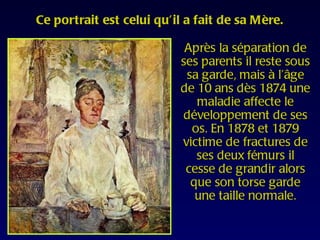 Ce portrait est celui qu’il a fait de sa Mère.

                           Après la séparation de
                          ses parents il reste sous
                           sa garde, mais à l’âge
                          de 10 ans dès 1874 une
                             maladie affecte le
                          développement de ses
                            os. En 1878 et 1879
                          victime de fractures de
                             ses deux fémurs il
                           cesse de grandir alors
                            que son torse garde
                             une taille normale.
 