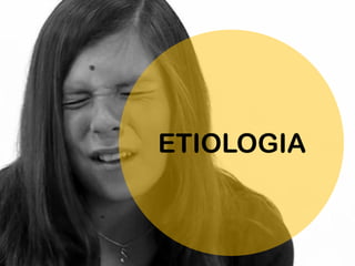 ETIOLOGIA
 