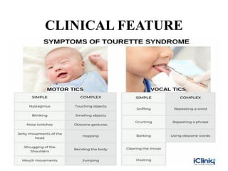 Visual Tics Tourette's disorder or Tics disorder pptx | PPTX