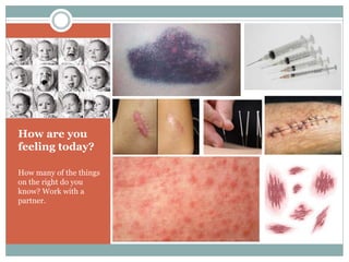 How are you
feeling today?
How many of the things
on the right do you
know? Work with a
partner.
 