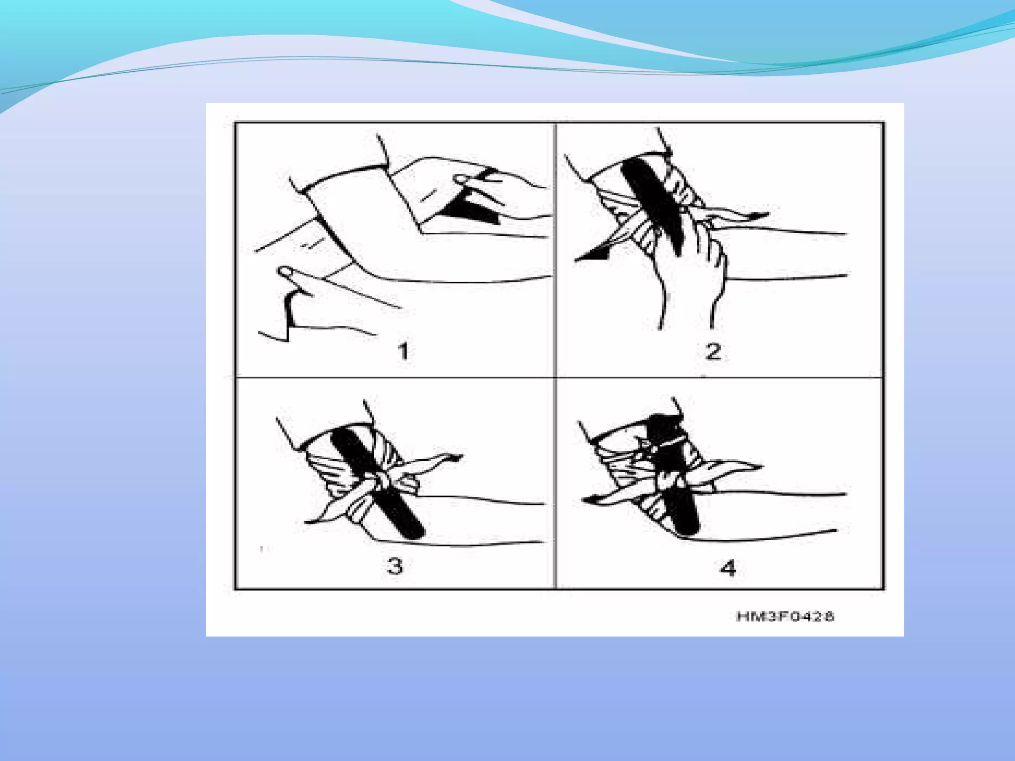 Tourniquet | PPT