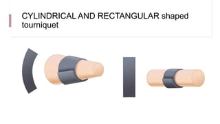 CYLINDRICAL AND RECTANGULAR shaped
tourniquet
 