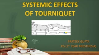 SYSTEMIC EFFECTS
OF TOURNIQUET
PRATEEK GUPTA
PG (1ST YEAR ANESTHESIA)
 