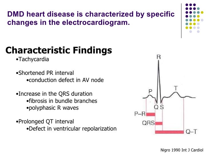 Towards Gene Therapy For Duchenne Muscular Dystrophy Heart Disease