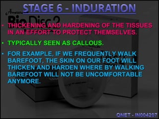 • THICKENING AND HARDENING OF THE TISSUESTHICKENING AND HARDENING OF THE TISSUES
IN AN EFFORT TO PROTECT THEMSELVES.IN AN EFFORT TO PROTECT THEMSELVES.
• TYPICALLY SEEN AS CALLOUS.TYPICALLY SEEN AS CALLOUS.
• FOR EXAMPLE, IF WE FREQUENTLY WALKFOR EXAMPLE, IF WE FREQUENTLY WALK
BAREFOOT, THE SKIN ON OUR FOOT WILLBAREFOOT, THE SKIN ON OUR FOOT WILL
THICKEN AND HARDEN WHERE BY WALKINGTHICKEN AND HARDEN WHERE BY WALKING
BAREFOOT WILL NOT BE UNCOMFORTABLEBAREFOOT WILL NOT BE UNCOMFORTABLE
ANYMORE.ANYMORE.
 