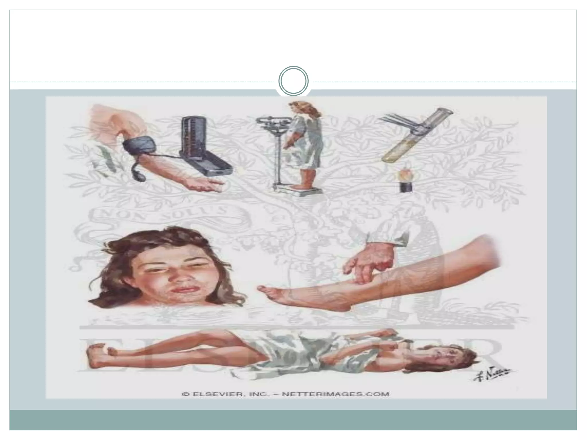 Toxemia in-pregnancy