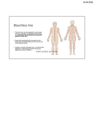 16-04-2018
Blaschkos line
• The lines do not correspond to any known
nervous, vascular or lymphatic structures,
but represent the developmental growth
pattern of the skin.
• Generally longitudinally oriented on the
limbs and circumferential on the trunk, but
not perfectly linear.
• Implies a mosaic disorder (e.g., incontinentia
pigmenti, inflammatory linear verrucous
epidermal nevus) (ILVEN).
TONY SCARIA 2010 KMC
 
