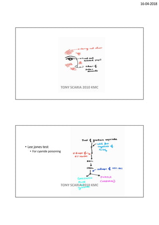 16-04-2018
TONY SCARIA 2010 KMC
• Lee jones test
• For cyanide poisoning
TONY SCARIA 2010 KMC
 