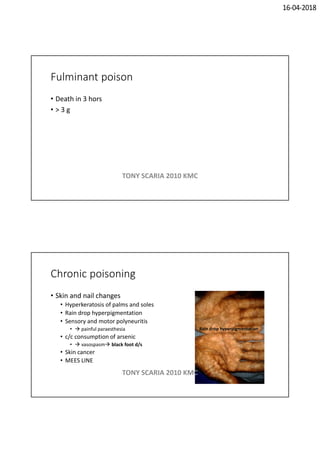 16-04-2018
Fulminant poison
• Death in 3 hors
• > 3 g
TONY SCARIA 2010 KMC
Chronic poisoning
• Skin and nail changes
• Hyperkeratosis of palms and soles
• Rain drop hyperpigmentation
• Sensory and motor polyneuritis
•  painful paraesthesia
• c/c consumption of arsenic
•  vasospasm black foot d/s
• Skin cancer
• MEES LINE
Rain drop hyperpigmentation
TONY SCARIA 2010 KMC
 