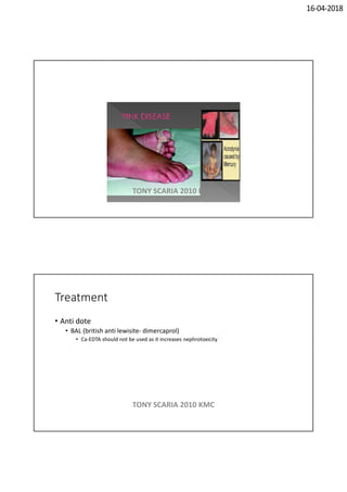 16-04-2018
TONY SCARIA 2010 KMC
Treatment
• Anti dote
• BAL (british anti lewisite- dimercaprol)
• Ca-EDTA should not be used as it increases nephrotoxicity
TONY SCARIA 2010 KMC
 