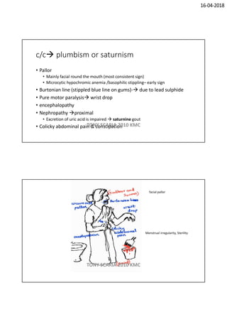 16-04-2018
c/c plumbism or saturnism
• Pallor
• Mainly facial round the mouth (most consistent sign)
• Microcytic hypochromic anemia /basophilic stippling– early sign
• Burtonian line (stippled blue line on gums)- due to lead sulphide
• Pure motor paralysis wrist drop
• encephalopathy
• Nephropathy proximal
• Excretion of uric acid is impaired  saturnine gout
• Colicky abdominal pain & constipationTONY SCARIA 2010 KMC
facial pallor
Menstrual irregularity, Sterility
TONY SCARIA 2010 KMC
 
