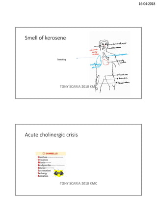16-04-2018
Smell of kerosene
Sweating
TONY SCARIA 2010 KMC
Acute cholinergic crisis
TONY SCARIA 2010 KMC
 