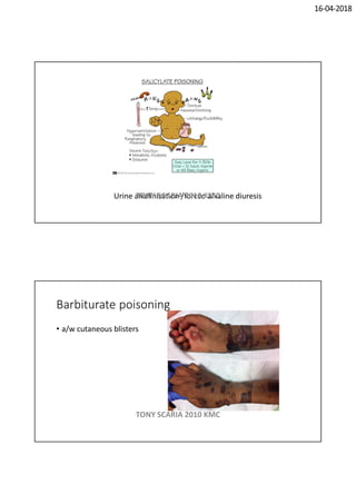 16-04-2018
Urine alkalinisation /forced alkaline diuresisTONY SCARIA 2010 KMC
Barbiturate poisoning
• a/w cutaneous blisters
TONY SCARIA 2010 KMC
 