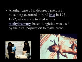 • Another case of widespread mercury
poisoning occurred in rural Iraq in 1971-
1972, when grain treated with a
methylmercury-based fungicide was used
by the rural population to make bread.
 