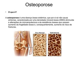 Osteoporose
•   O que é?

A osteoporose é uma doença óssea sistémica, que por si só não causa
   sintomas, caracterizada por uma densidade mineral óssea (DMO) diminuída
   e alterações da microarquitectura e da resistência ósseas que causam
   aumento da fragilidade óssea e, consequentemente, aumento do risco de
   fracturas.
 