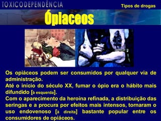 Tipos de drogas Os opiáceos podem ser consumidos por qualquer via de administração.  Até o início do século XX, fumar o ópio era o hábito mais difundido [ à esquerda ].  Com o aparecimento da heroína refinada, a distribuição das seringas e a procura por efeitos mais intensos, tornaram o uso endovenoso [ à direita ] bastante popular entre os consumidores de opiáceos. Ópiaceos TOXICODEPENDÊNCIA 